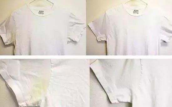 衣服發黃了怎么辦?